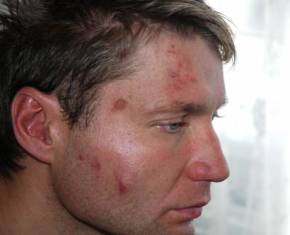 З заяви адвоката: «…в салоні автомобіля мені наділи на голову чорний синтетичний пакет (капюшон) та поставили на підлозі на коліна та лікті. Потім всі разом, працівники «Сокіл» УБОЗ почали бити мене в різні частини тіла, переважно по спині та тулубу, а також по голові руками та ногами…»